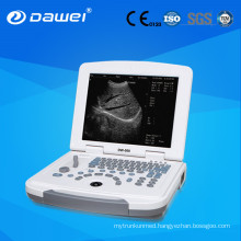high quality echo LED disply portable ultrasonic diagnostic scanner